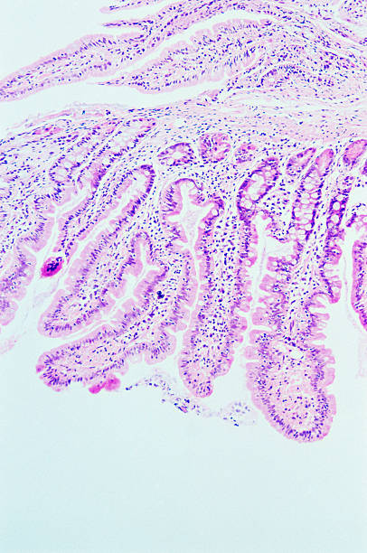 jejunal darmschleimhaut - villus stock-fotos und bilder
