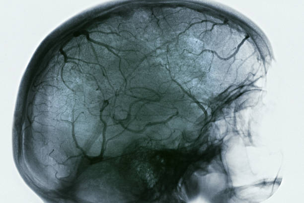 arteriogramma di testa - unknown gender foto e immagini stock
