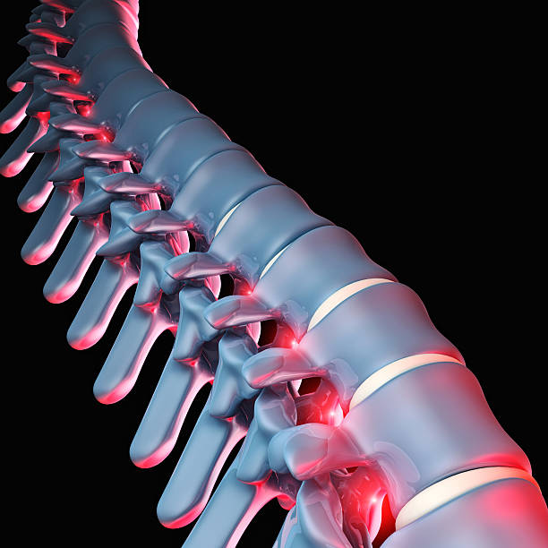 인간 척추 뼈 3d - human spine chiropractor three dimensional shape healthcare and medicine 뉴스 사진 이미지