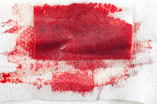 istock Gauze with blood 578122224