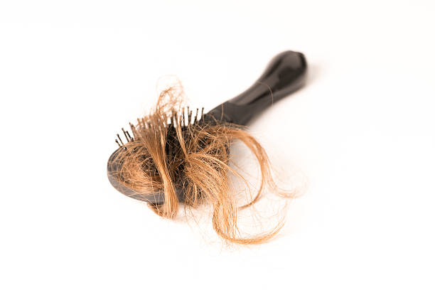 istock Hair Loss on white background 578824942