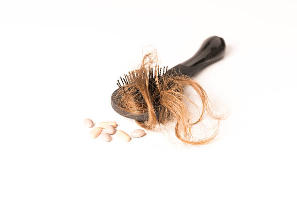 istock Hair Loss treatment on white background 578824998