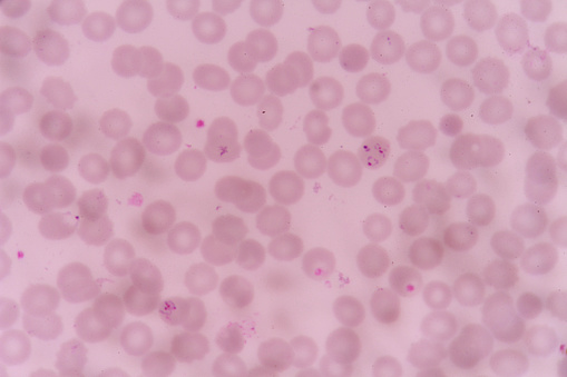 plasmodium falciparum  infections red blood cells