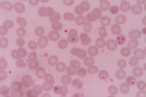 plasmodium falciparum  infections red blood cells