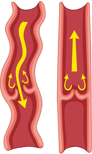 Varicose veins in human body illustration