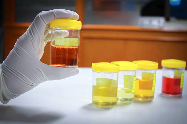 Urrine Sample 280+ Nurse Urine Sample Stock Photos, Pictures & Royalty-Free Images ...