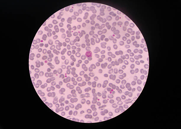 istock multiple in fection of red blood cells 582310700