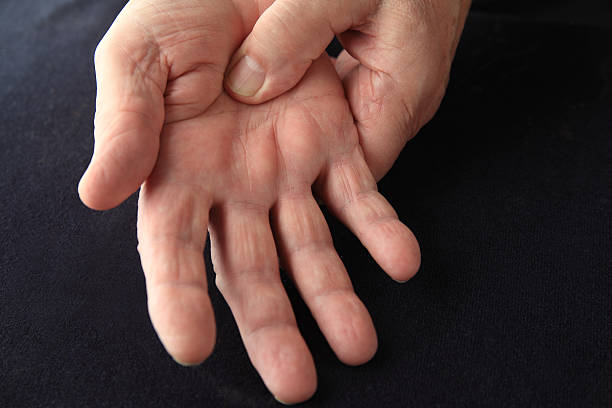 istock Man with pain in his palm 582312186