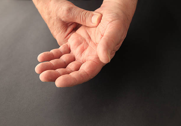 istock Man with pain at base of hand 582316400
