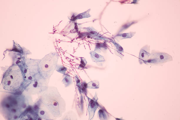 Candida view in microscopic. stock photo