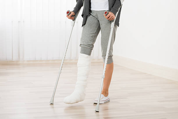 Woman Using Crutches While Walking Close-up Of Woman Leg In Plaster Cast Using Crutches While Walking broken leg stock pictures, royalty-free photos & images