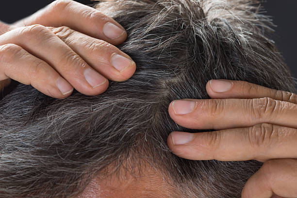 istock Man Examining His White Hair 584207690