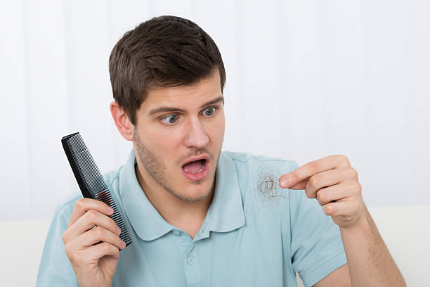 istock Man Suffering From Hair Loss 584232672