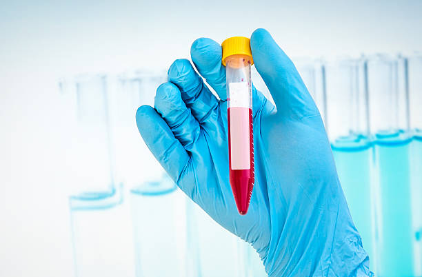 istock Test-tube with blood sample for blank label 585052520