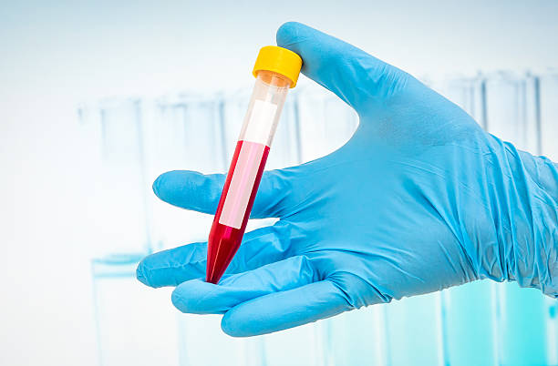 istock Test-tube with blood sample for blank label 585052538