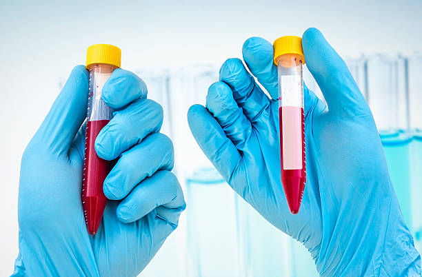 istock Test-tube with blood sample for blank label 585052564