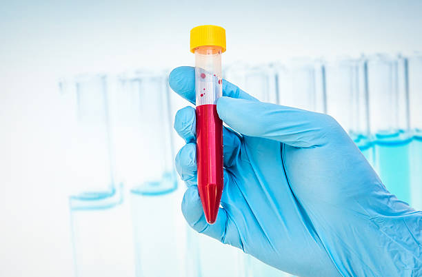 istock Test-tube with blood sample for BLOOD test 585052578