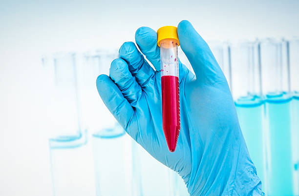 istock Test-tube with blood sample for BLOOD test 585052600