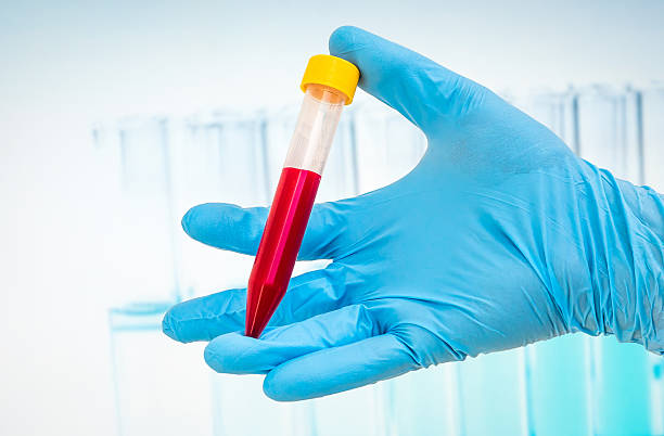 istock Test-tube with blood sample for BLOOD test 585052614