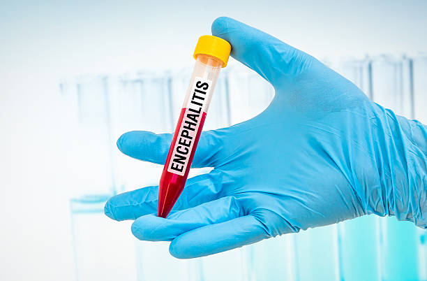 istock Test-tube with blood sample for ENCEPHALITIS test 585052816