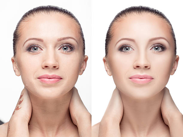 istock woman,  before and after retouch 585057288