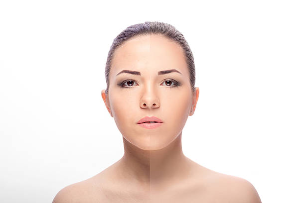 istock woman,  before and after retouch 585062974