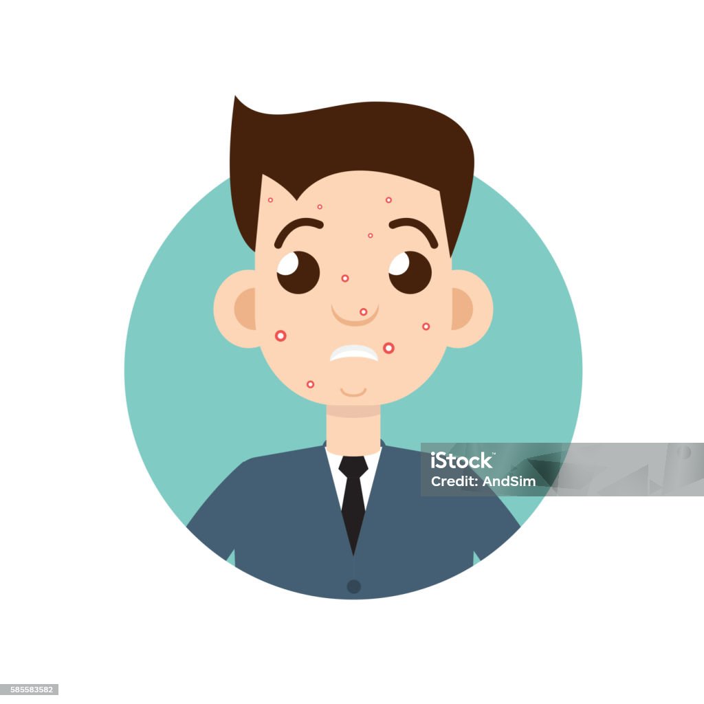 acne man Acne stock vector