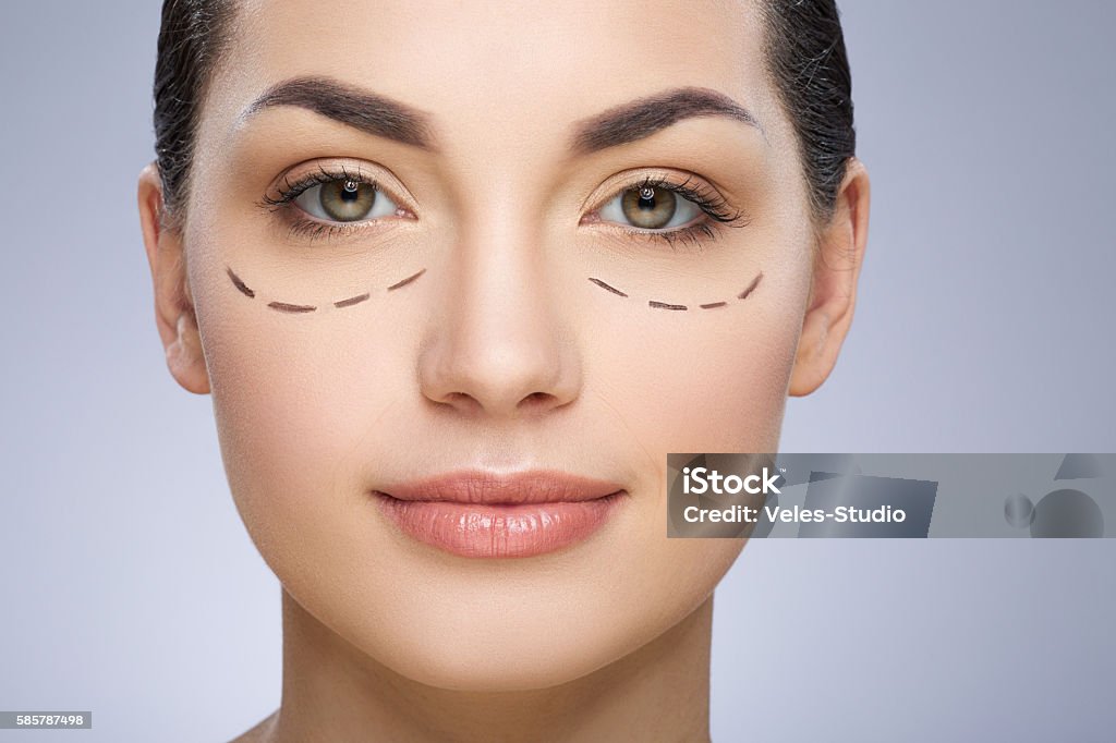 Dashed line under girl's eyes Dashed lines under girl's eyes. Beautiful girl smiling. Plastic surgery, beauty portrait, closeup Eyelid Stock Photo