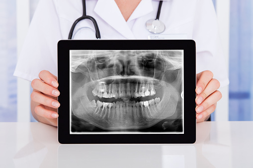 Female Doctor Holding Digital Tablet With Teeth X-ray On It