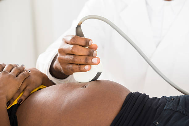 ecografia in movimento della mano del medico sulla pancia della donna incinta - ultrasound gynecologist gynecological examination human pregnancy foto e immagini stock