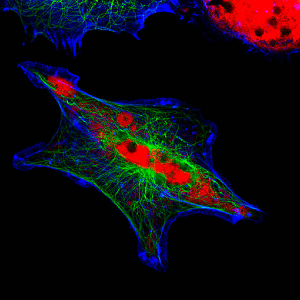 real fluorescencia microscópicos vista de células de neuroblastoma humano - stem cell human cell animal cell science fotografías e imágenes de stock