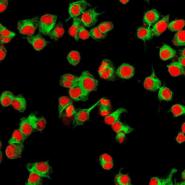 참되다 형광 현미경 남퐁 of human neuroblastoma cells - stem cell human cell animal cell science 뉴스 사진 이미지