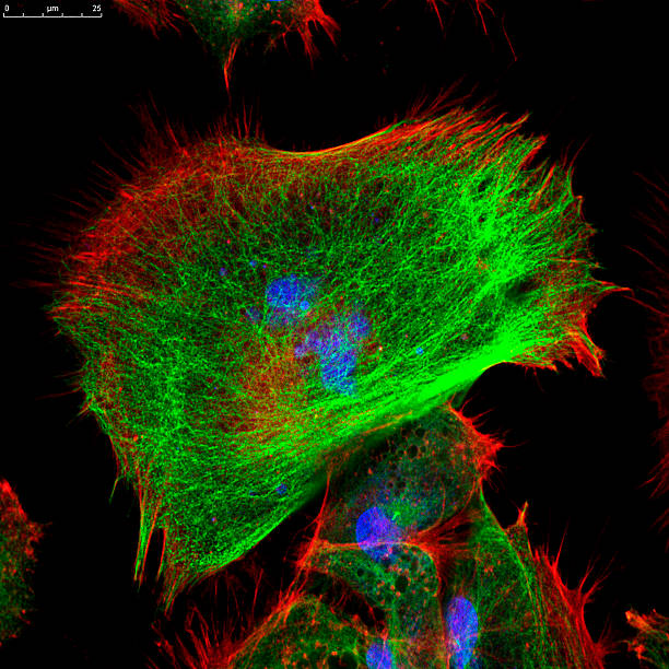 istock Confocal microscopy of fibroblast cells 586076140
