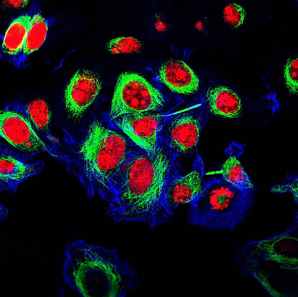 células hela etiquetadas con colorantes fluorescentes - ovary human cell cell high scale magnification fotografías e imágenes de stock