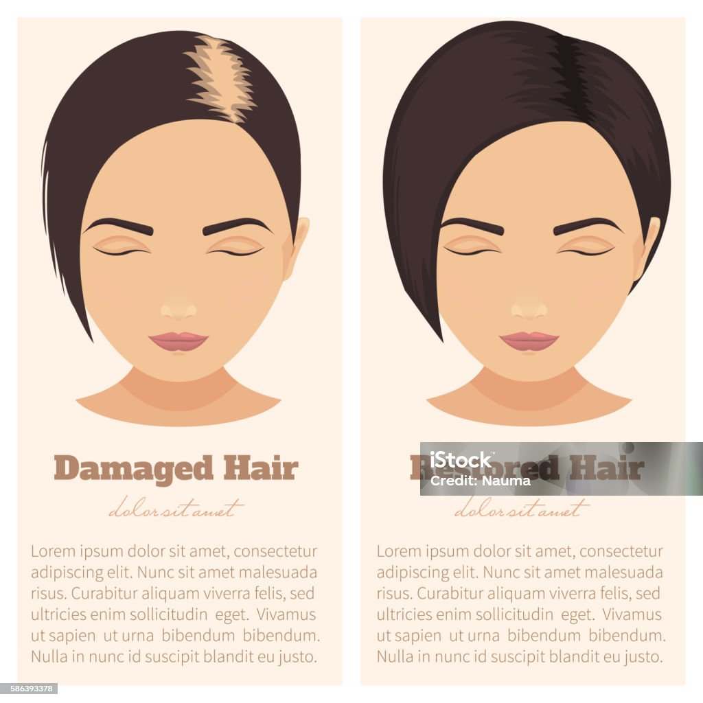 Hair Loss In Women Stock Illustration - Download Image Now - Females,  Illustration, Adult - iStock