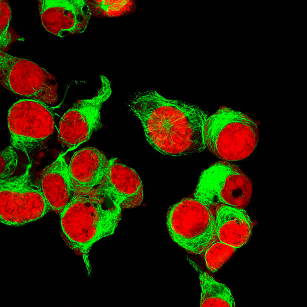 istock Real fluorescence microscopic view of human neuroblastoma cells 586706778