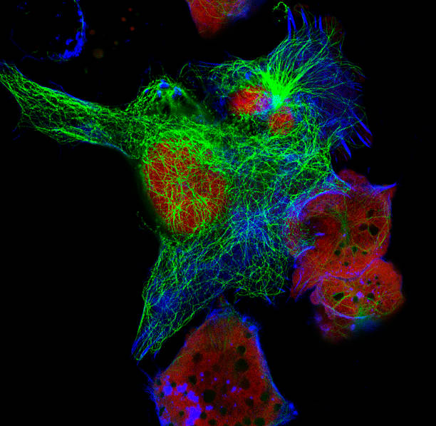 istock Real fluorescence microscopic view of mice neuroblastoma cell line 586707878