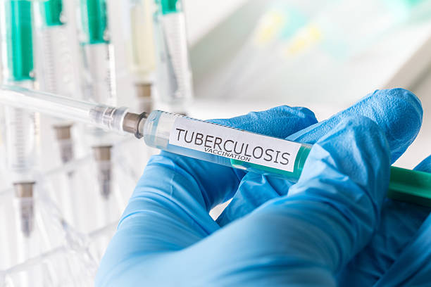 tuberculosis vaccination stock photo