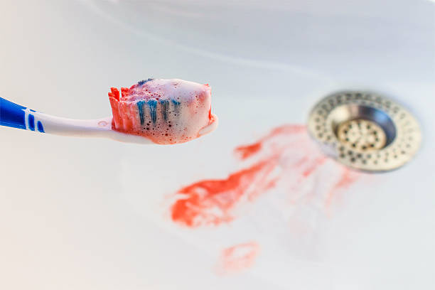 blood on the toothbrush on background of sink. - gums imagens e fotografias de stock