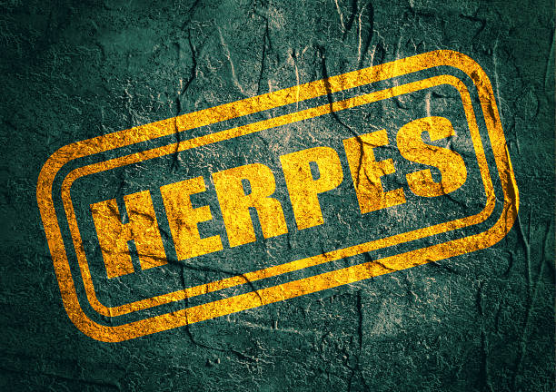 istock stamp with herpes text over grunge background 588984710
