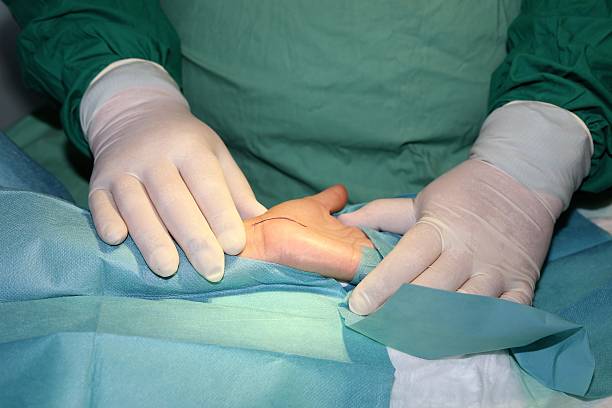 Surgeon operates carpal tunnel syndrome Surgeon operates carpal tunnel syndrome carpal tunnel syndrome photos stock pictures, royalty-free photos & images