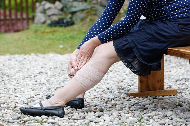 mujer con venas varicosas aplicación de venda de compresión - stockings human leg female women fotografías e imágenes de stock