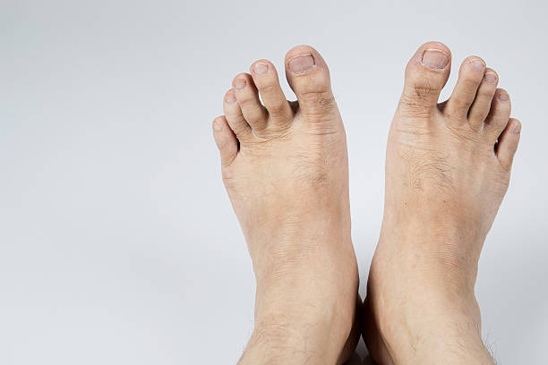 istock Male feet on gray background 590036302