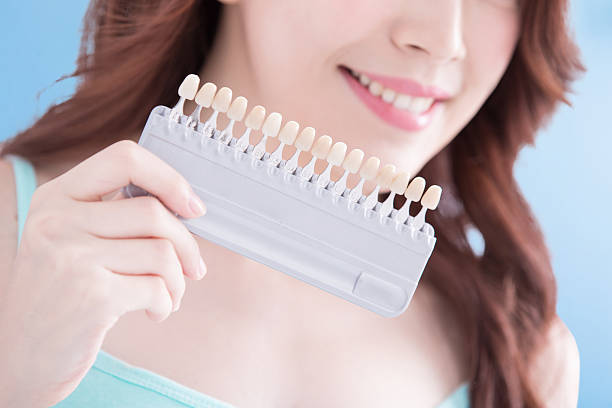 istock Woman teeth whitening concept 590164090