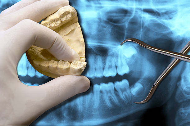 istock dentist hand with orthodontic tool show wisdom teeth 590173672
