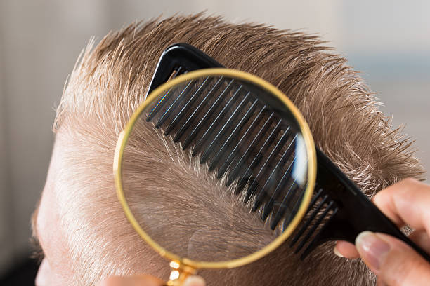 istock Doctor Looking At Patient's Hair Through Magnifying Glass 590614868