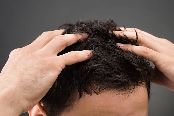 Cropped Image Of Man Suffering From Dandruff Cropped image of man suffering from dandruff against gray background dandruff men stock pictures, royalty-free photos & images