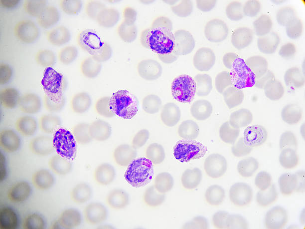 Malaria parasite Malaria parasite in peripheral blood smear malaria blood sample stock pictures, royalty-free photos & images