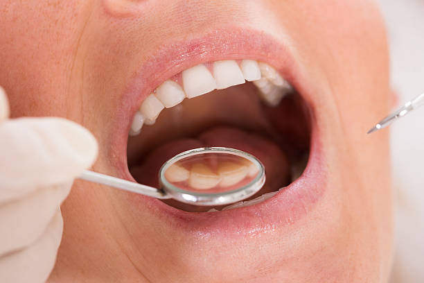 istock Female Patient Getting Dental Checkup At Clinic 591420870