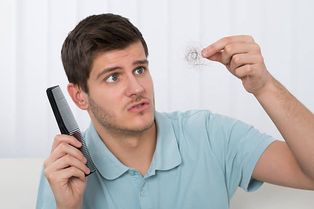Man Suffering From Hair Loss